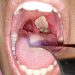 Diphtheria Outbreak Threatens Northern Nigeria’s Schoolchildren